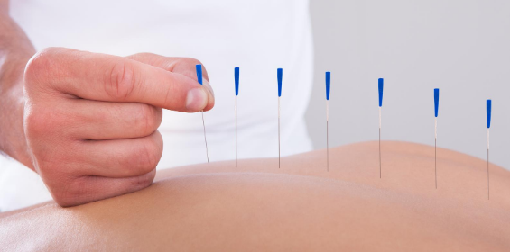 Nat Broad Physiotherapy Penrith acupuncture cumbria